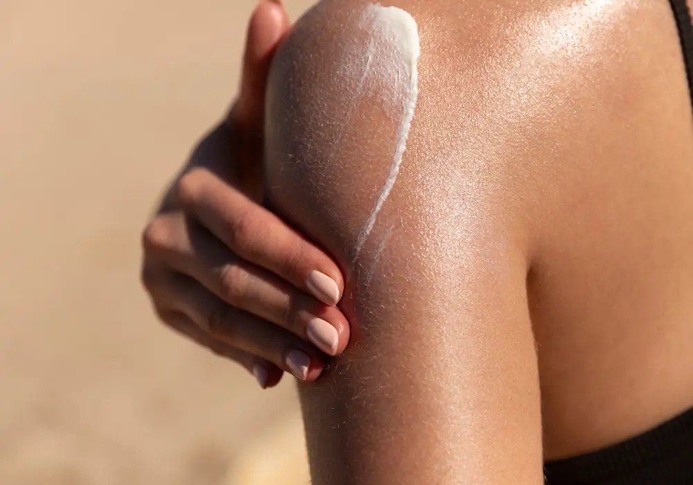 Comment guérir rapidement un coup de soleil ? 12 conseils d'expert.