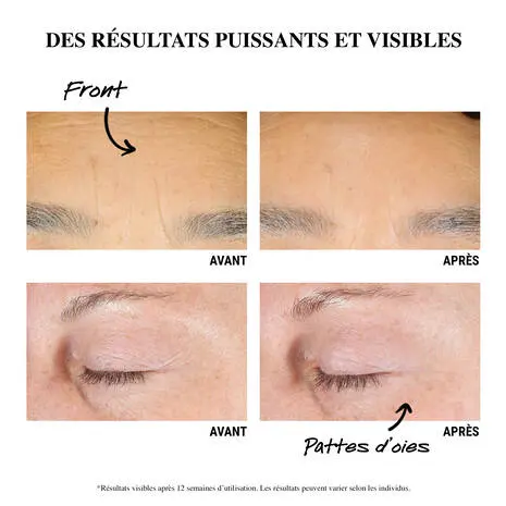 Découvrez comment intégrer le rétinol à votre routine, les erreurs à éviter et nos produits favoris comme Kiehl's ou CeraVe.